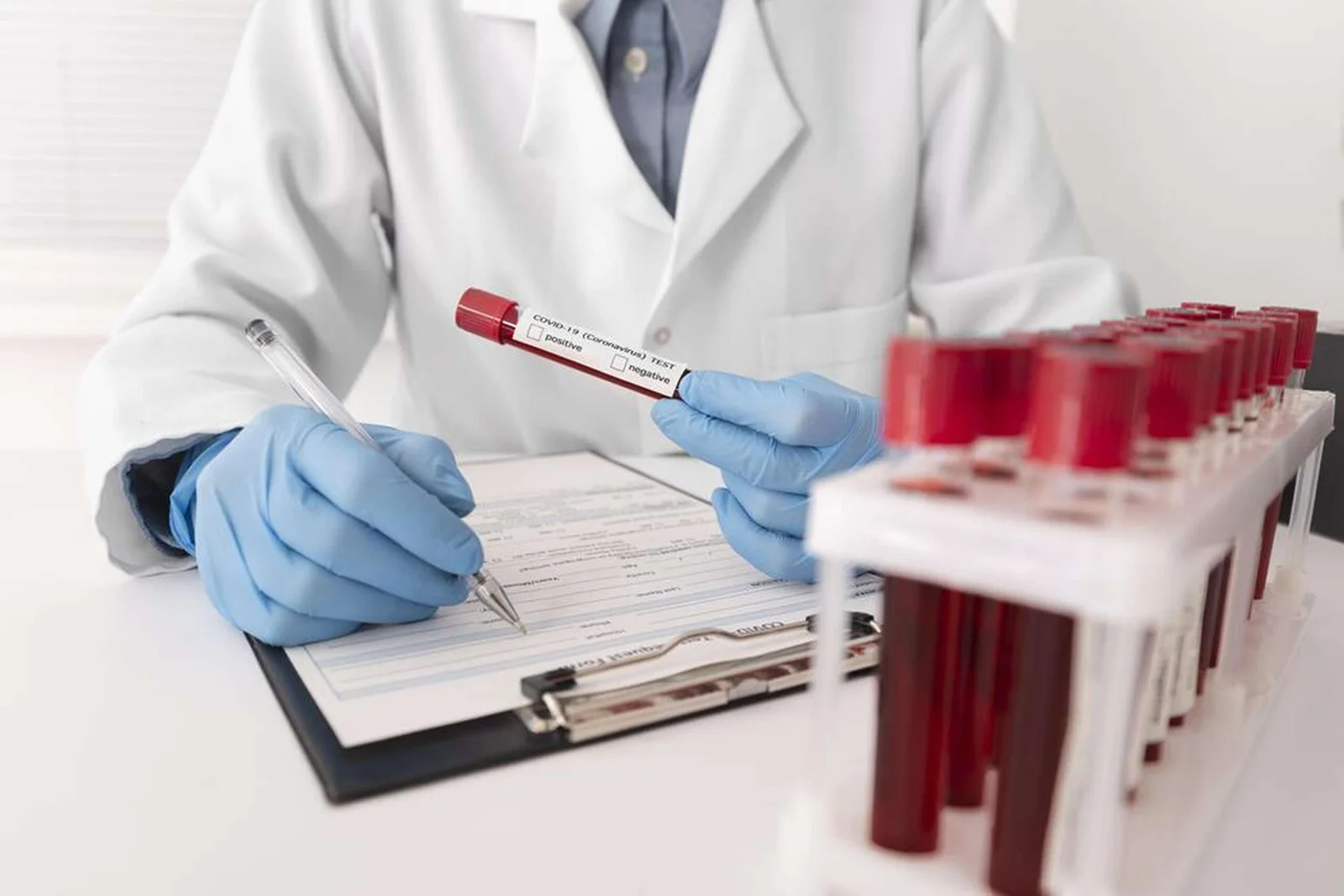 Hormonal Assays