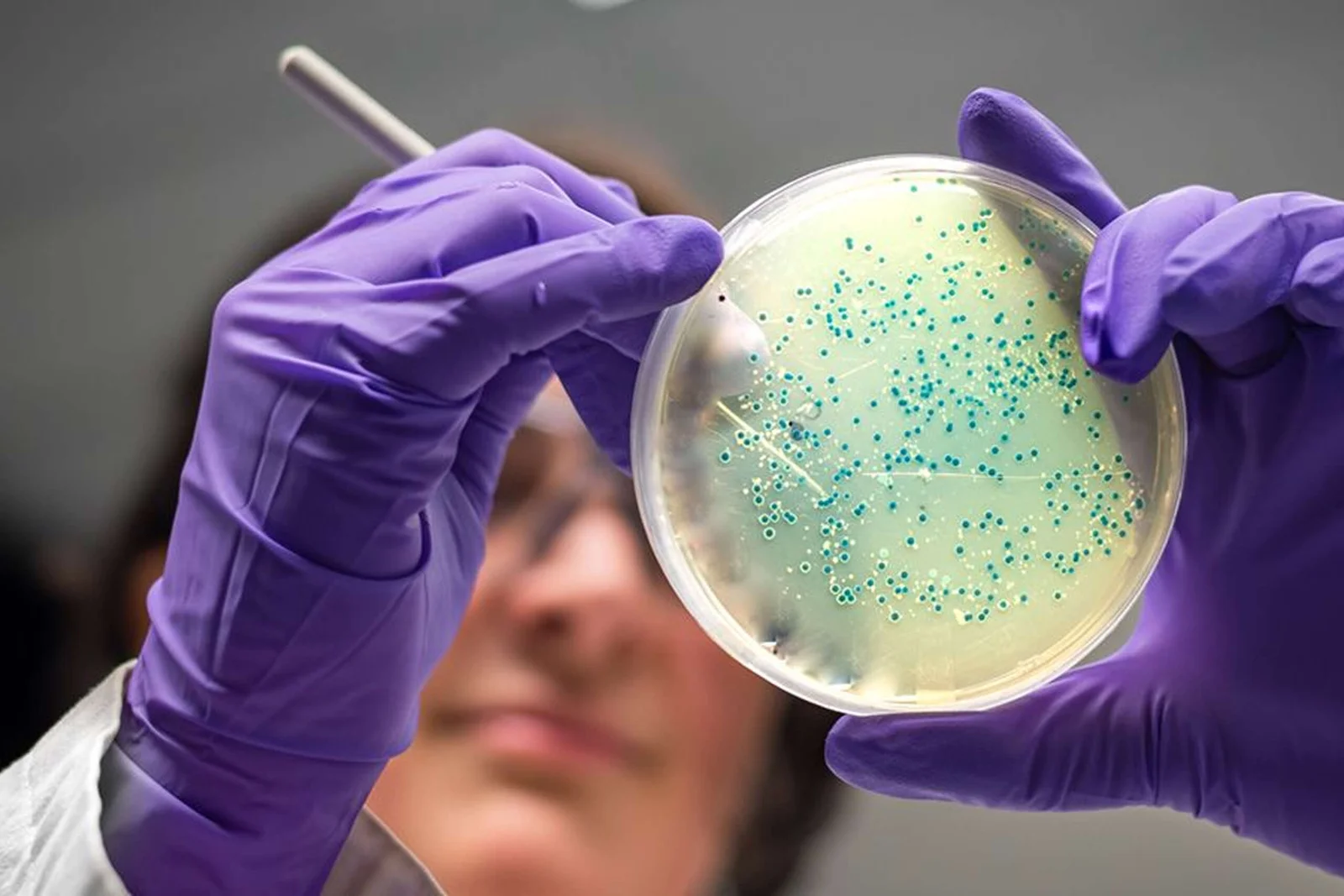 Microbiology